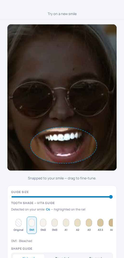 SmileCast editor — whitening preview on a selfie